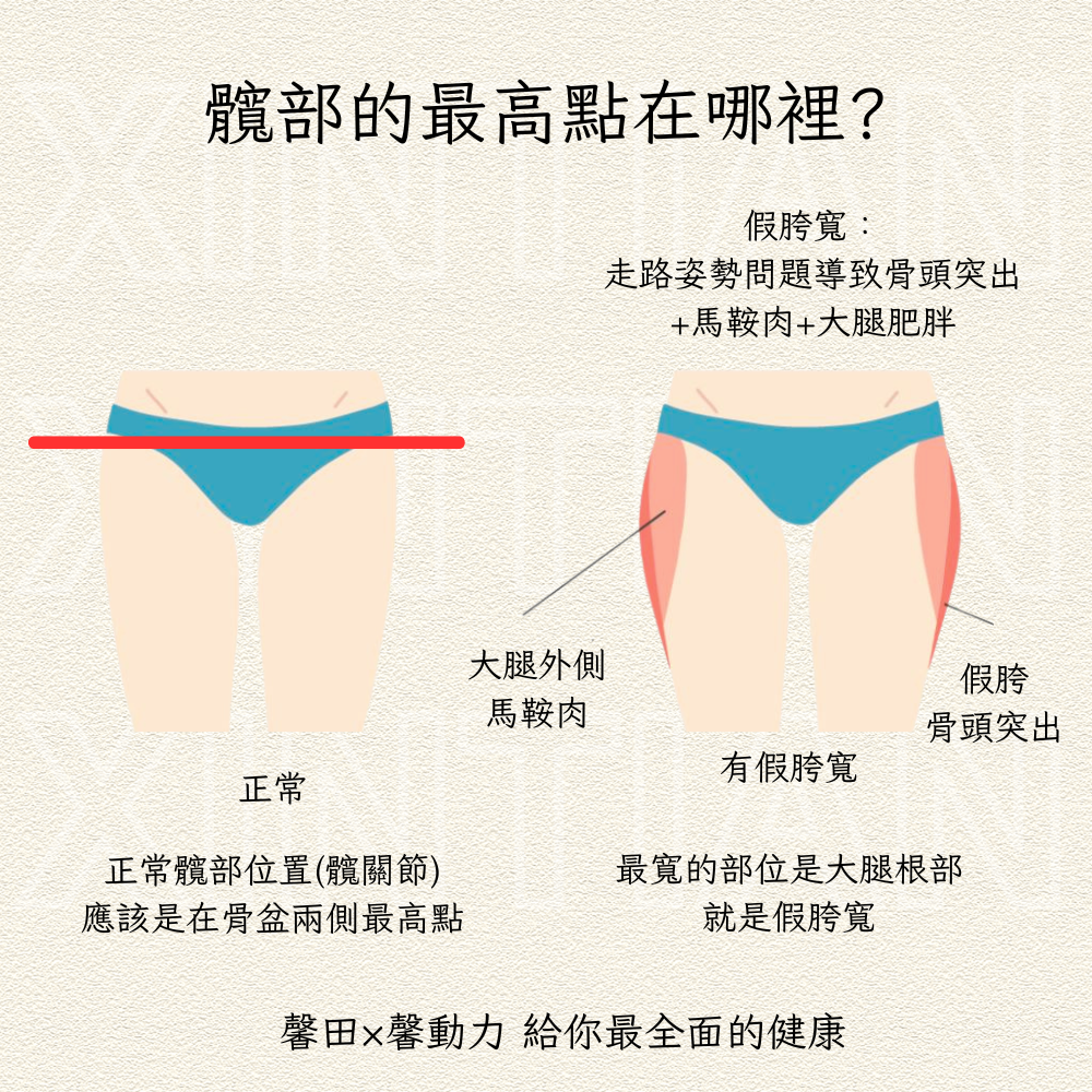 髖部的最高點在哪裡？
